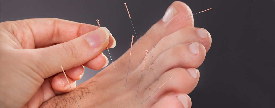 acupuncture-as-clinics-service