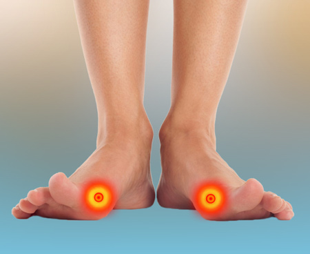 bunions-as-foot-pain