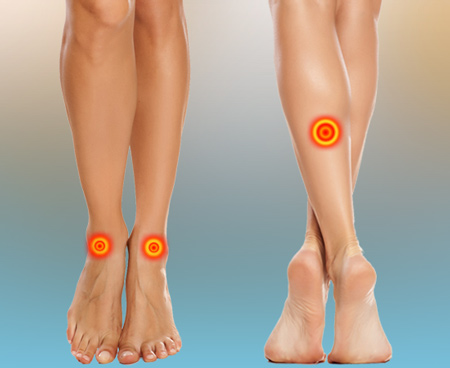 edema-as-leg-pain