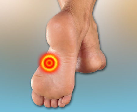 flat-feet-as-foot-pain