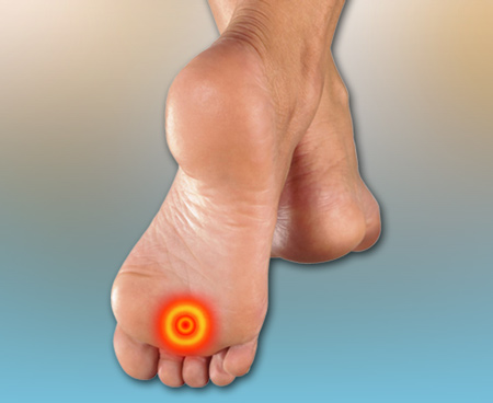 metatarsalagia-as-foot-pain