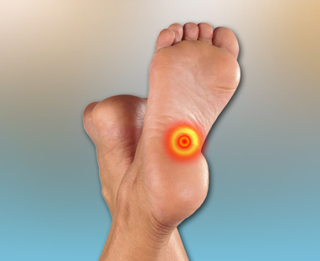 plantar-fasciitis-as-foot-pain