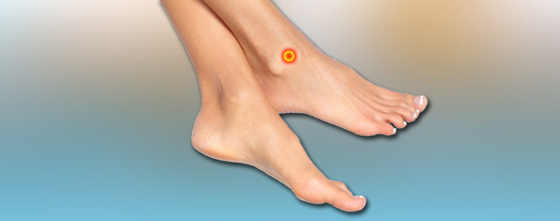 identify-the-capsular-impingement-as-ankle-pain-