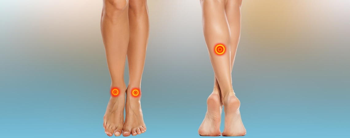 identify-the-edema-as-leg-pain-