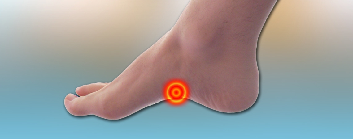 identify-the-high-arches-as-foot-pain-