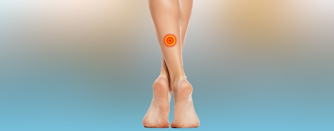 identify-the-spider-veins-as-leg-pain